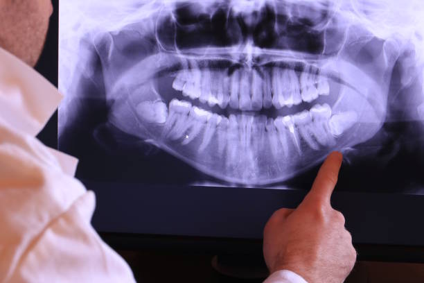 Best Emergency Root Canal Therapy in Black Diamond, FL